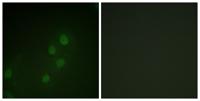 Myf-5 Polyclonal Antibody