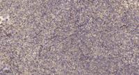 MYL7 Polyclonal Antibody