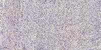 NBAS Polyclonal Antibody