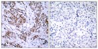 ERα Polyclonal Antibody