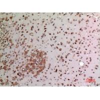 FGF-20 Polyclonal Antibody