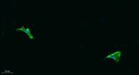 COL11A1 Polyclonal Antibody