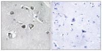 COL11A2 Polyclonal Antibody