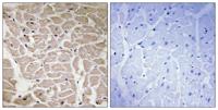 COL16A1 Polyclonal Antibody