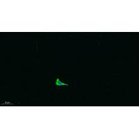 COL17A1 Polyclonal Antibody