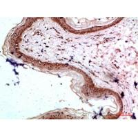 COL17A1 Polyclonal Antibody