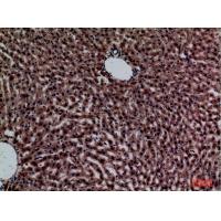 CRP Polyclonal Antibody