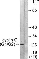 Cyclin G Polyclonal Antibody