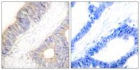 Cystatin A Polyclonal Antibody