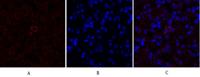 Cytokeratin 18 Polyclonal Antibody