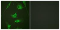Cytokeratin 8 Polyclonal Antibody