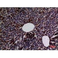 Amylase Polyclonal Antibody