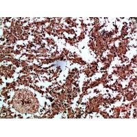 Annexin I Polyclonal Antibody