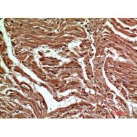 Dectin-2 Polyclonal Antibody