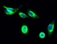 Desmin Polyclonal Antibody