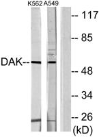DHA Kinase Polyclonal Antibody