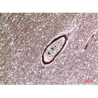 Dkk-1 Polyclonal Antibody