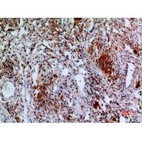 Apaf-1 Polyclonal Antibody