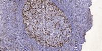 DNAM-1 Polyclonal Antibody