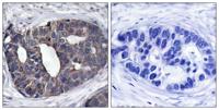 Dok-1 Polyclonal Antibody