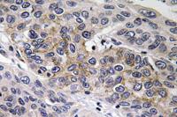 GCS-β-2 Polyclonal Antibody