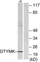 dTMP Kinase Polyclonal Antibody