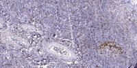 Dvl-2 Polyclonal Antibody