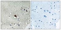 Dvl-3 Polyclonal Antibody
