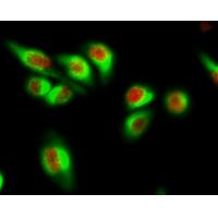 AR Polyclonal Antibody