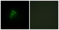 AR α2B Polyclonal Antibody