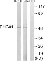 ARHGAP1 Polyclonal Antibody