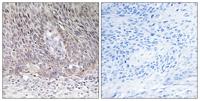 Arylsulfatase A Polyclonal Antibody