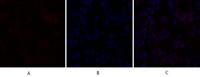 C/EBP β Polyclonal Antibody