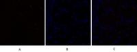C/EBP β Polyclonal Antibody