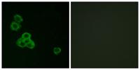 CaMKIIα/δ Polyclonal Antibody