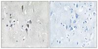 CaMKIIα/δ Polyclonal Antibody