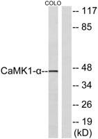 CaMKIα Polyclonal Antibody