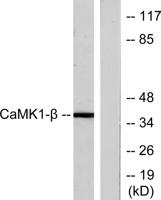 CaMKIβ Polyclonal Antibody