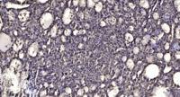 Casein Kinase Iγ2 Polyclonal Antibody