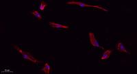 Caspase-3 Polyclonal Antibody