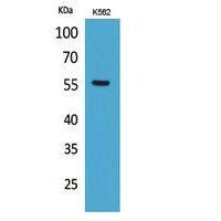 Glut5 Polyclonal Antibody