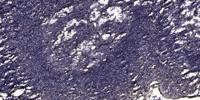 Maspin Polyclonal Antibody
