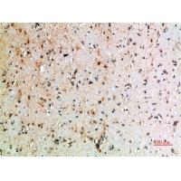 CD152 Polyclonal Antibody