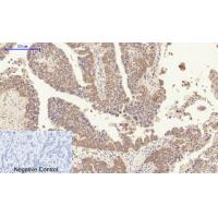 CD63 Polyclonal Antibody