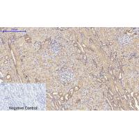 CD63 Polyclonal Antibody
