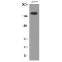 Macroglobulin α-2 Polyclonal Antibody