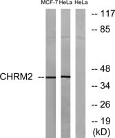 mAChR M2 Polyclonal Antibody