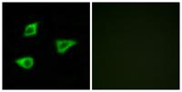 mAChR M4 Polyclonal Antibody
