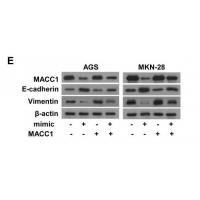MACC1 Polyclonal Antibody