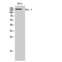 Ron α Polyclonal Antibody